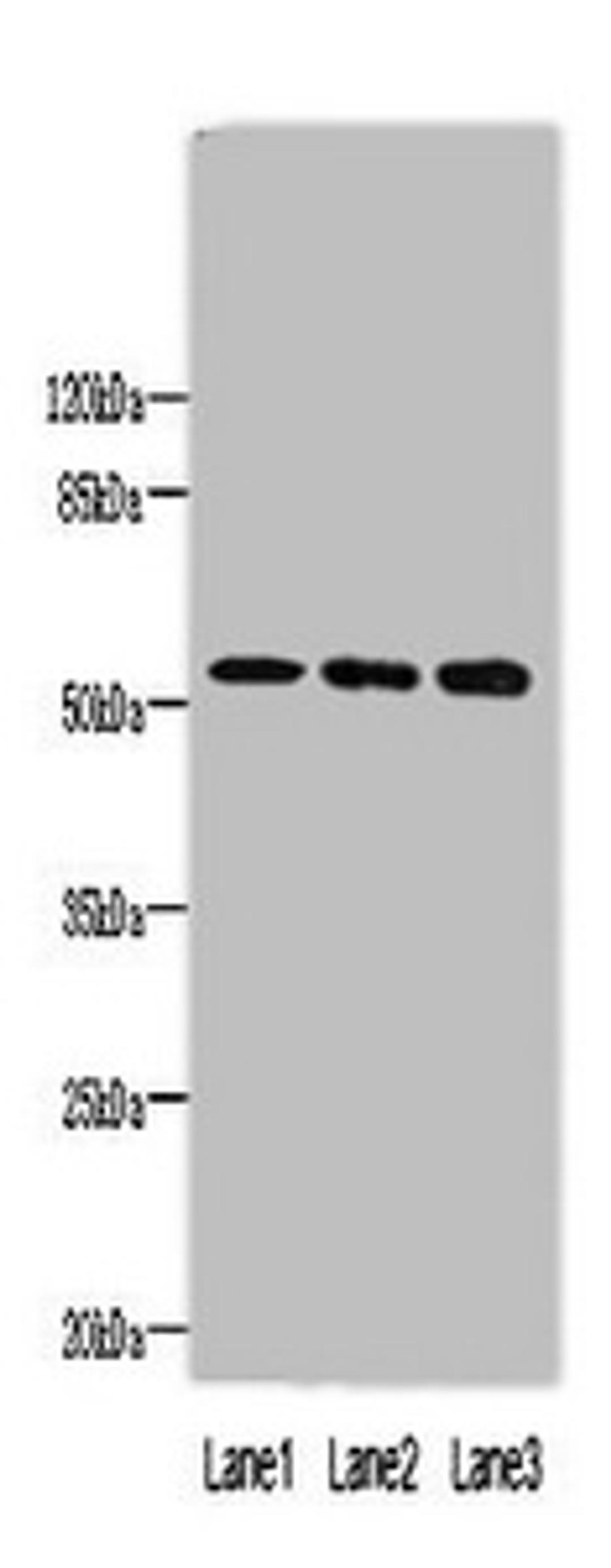 Western blot. All lanes: MINDY1 antibody at 8µg/ml. Lane 1: Mouse liver tissue. Lane 2: A549 whole cell lysate. Lane 3: HepG2 whole cell lysate. Secondary. Goat polyclonal to rabbit IgG at 1/10000 dilution. Predicted band size: 52, 37, 57, 42 kDa. Observed band size: 52 kDa
