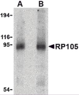 Western blot analysis of RP105 in human spleen tissue lysate with RP105 antibody at (A) 0.5 and (B) 1 μg/mL.