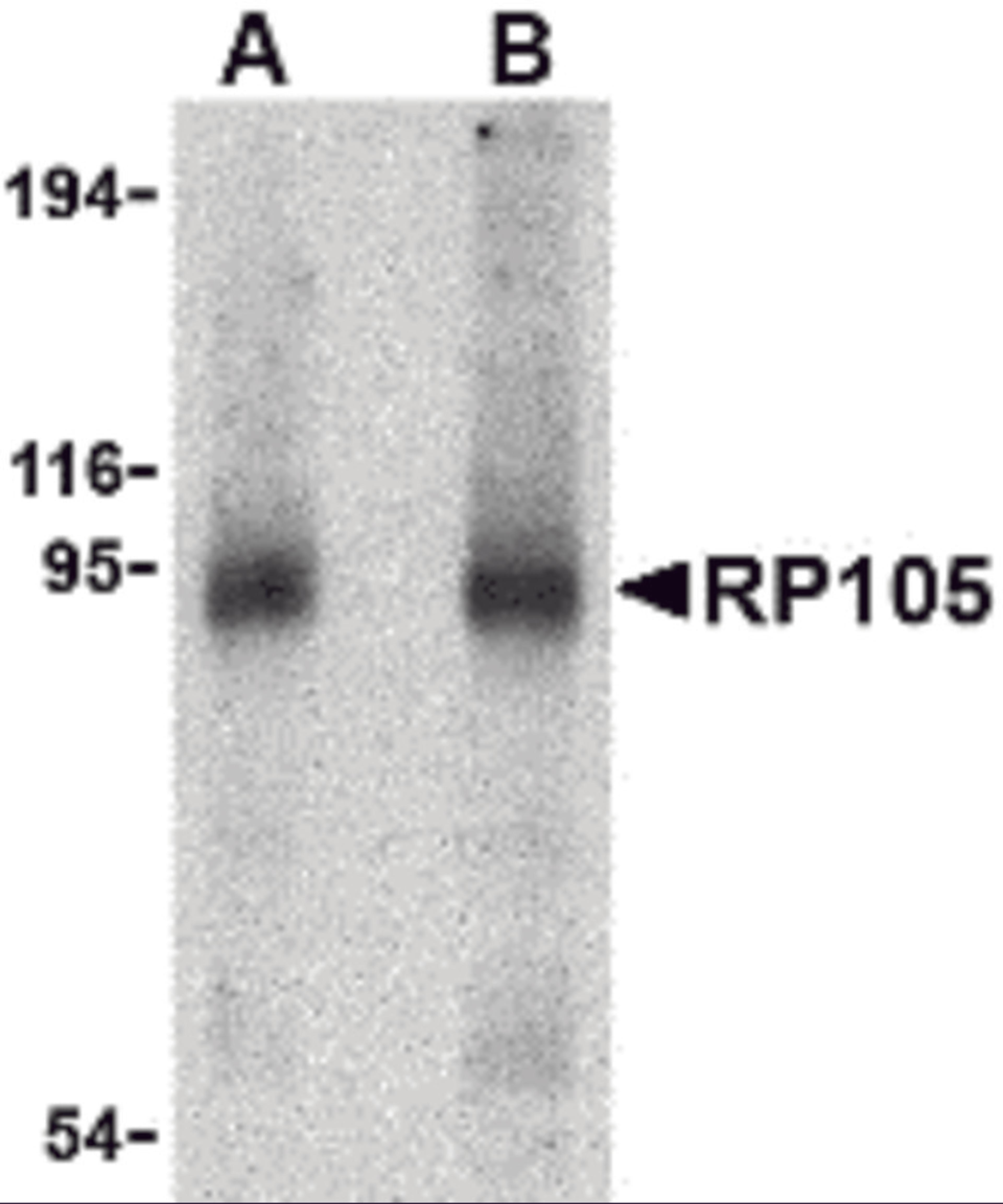 Western blot analysis of RP105 in human spleen tissue lysate with RP105 antibody at (A) 0.5 and (B) 1 μg/mL.