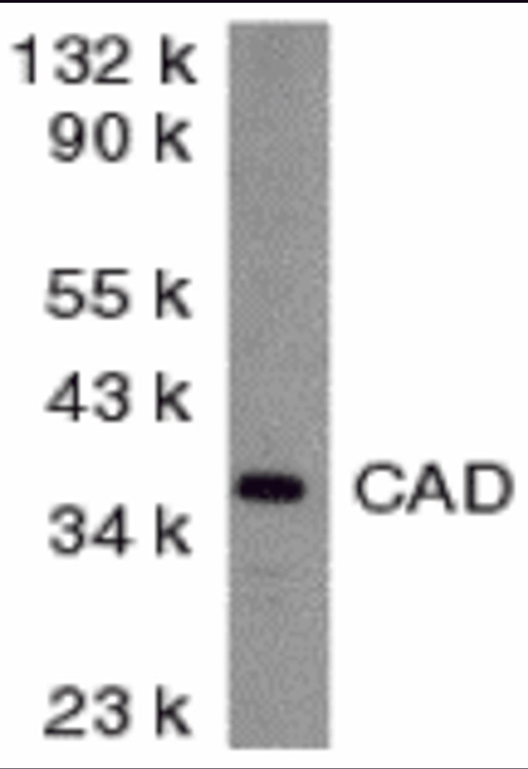 Western blot analysis of CAD in mouse kidney tissue lysate with CAD antibody at 2 μg/mL.