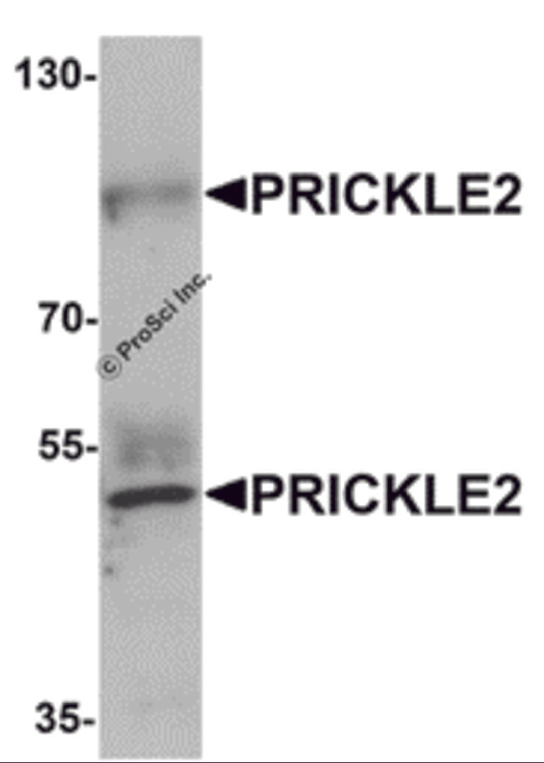 Western blot analysis of PRICKLE2 in A-20 lysate with PRICKLE2 antibody at 1 μg/mL.