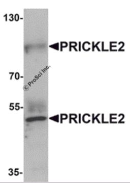 Western blot analysis of PRICKLE2 in A-20 lysate with PRICKLE2 antibody at 1 μg/mL.