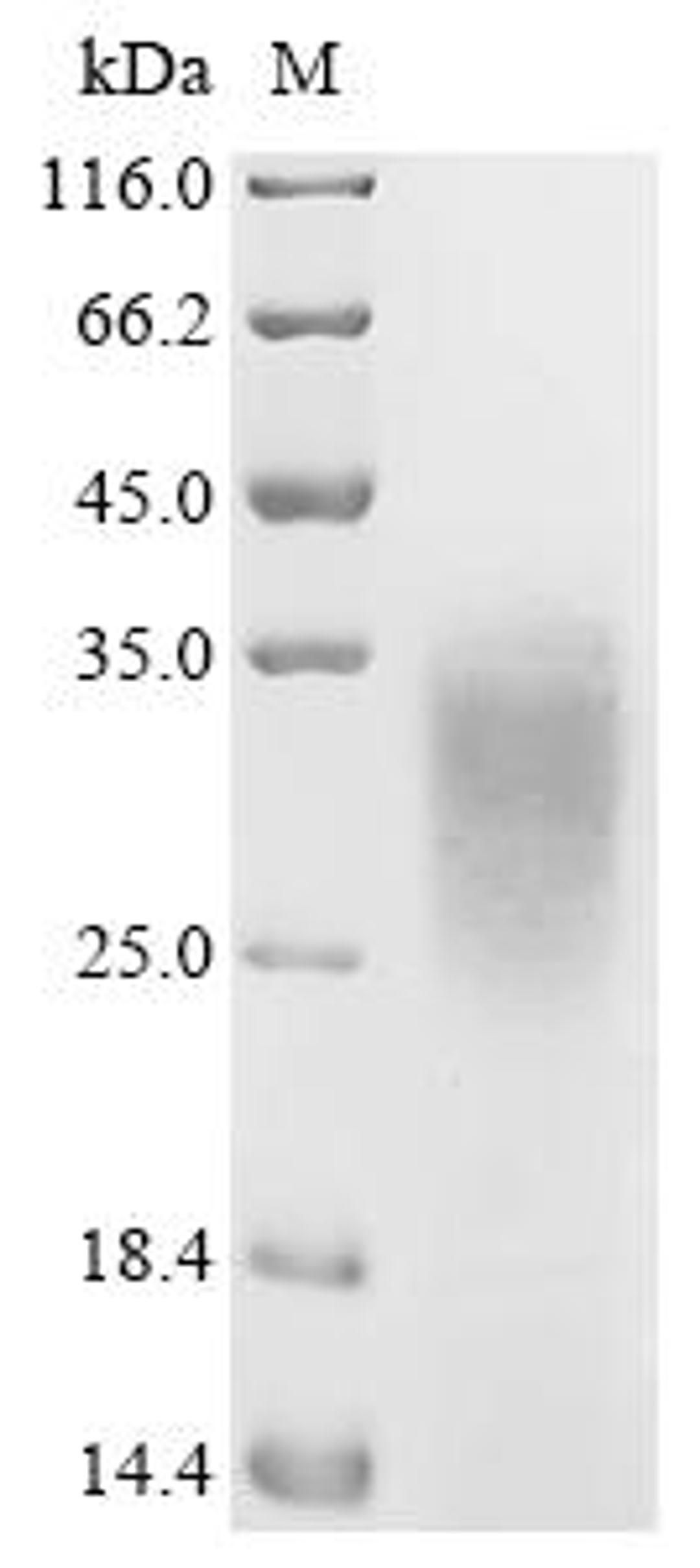(Tris-Glycine gel) Discontinuous SDS-PAGE (reduced) with 5% enrichment gel and 15% separation gel.