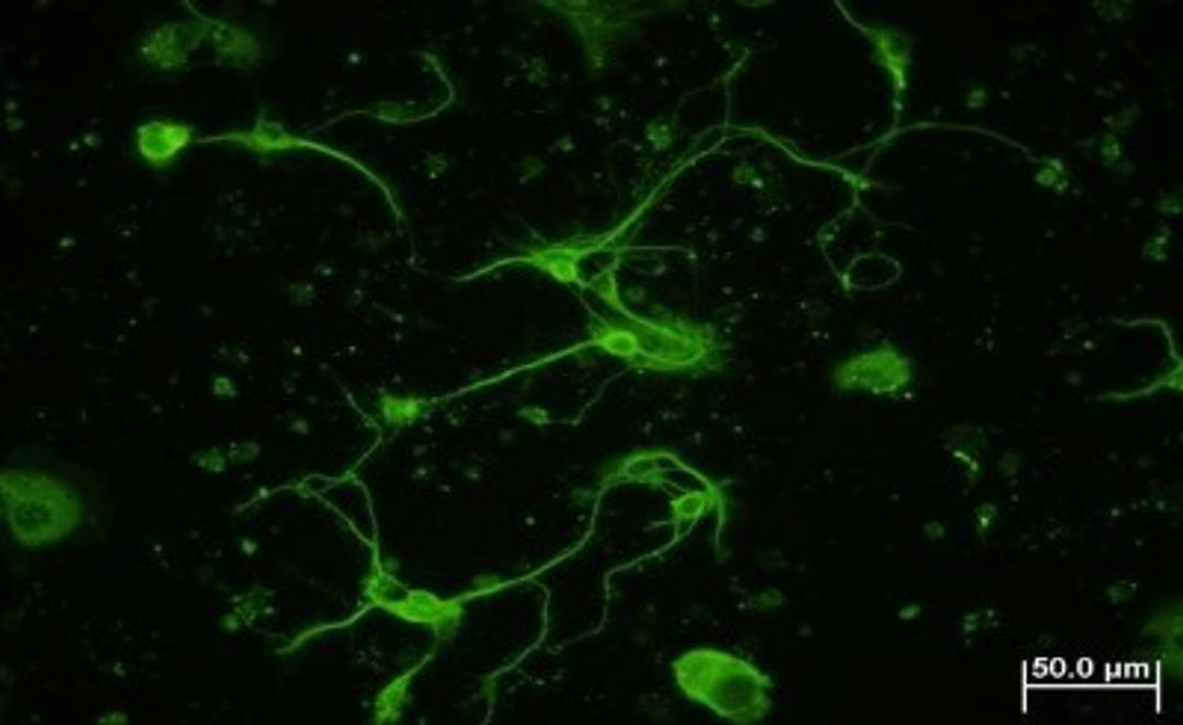 Immunocytochemistry/Immunofluorescence: beta Tubulin Antibody [NB600-936] - IF analysis of beta Tubulin in mouse hippocampal primary culture. Image courtesy of product review by Lin Yi-Wen.