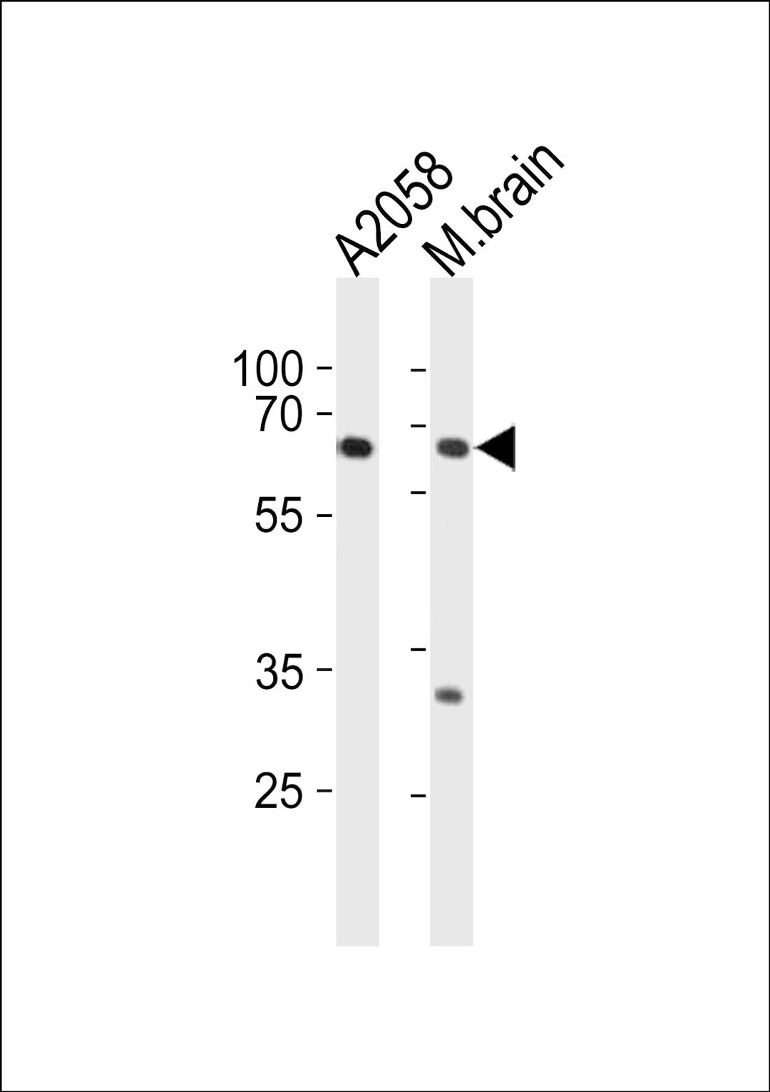 Western blot analysis in A2058 cell line and mouse brain tissue lysates (35ug/lane).