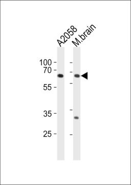 Western blot analysis in A2058 cell line and mouse brain tissue lysates (35ug/lane).