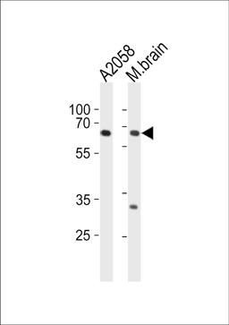 Western blot analysis in A2058 cell line and mouse brain tissue lysates (35ug/lane).