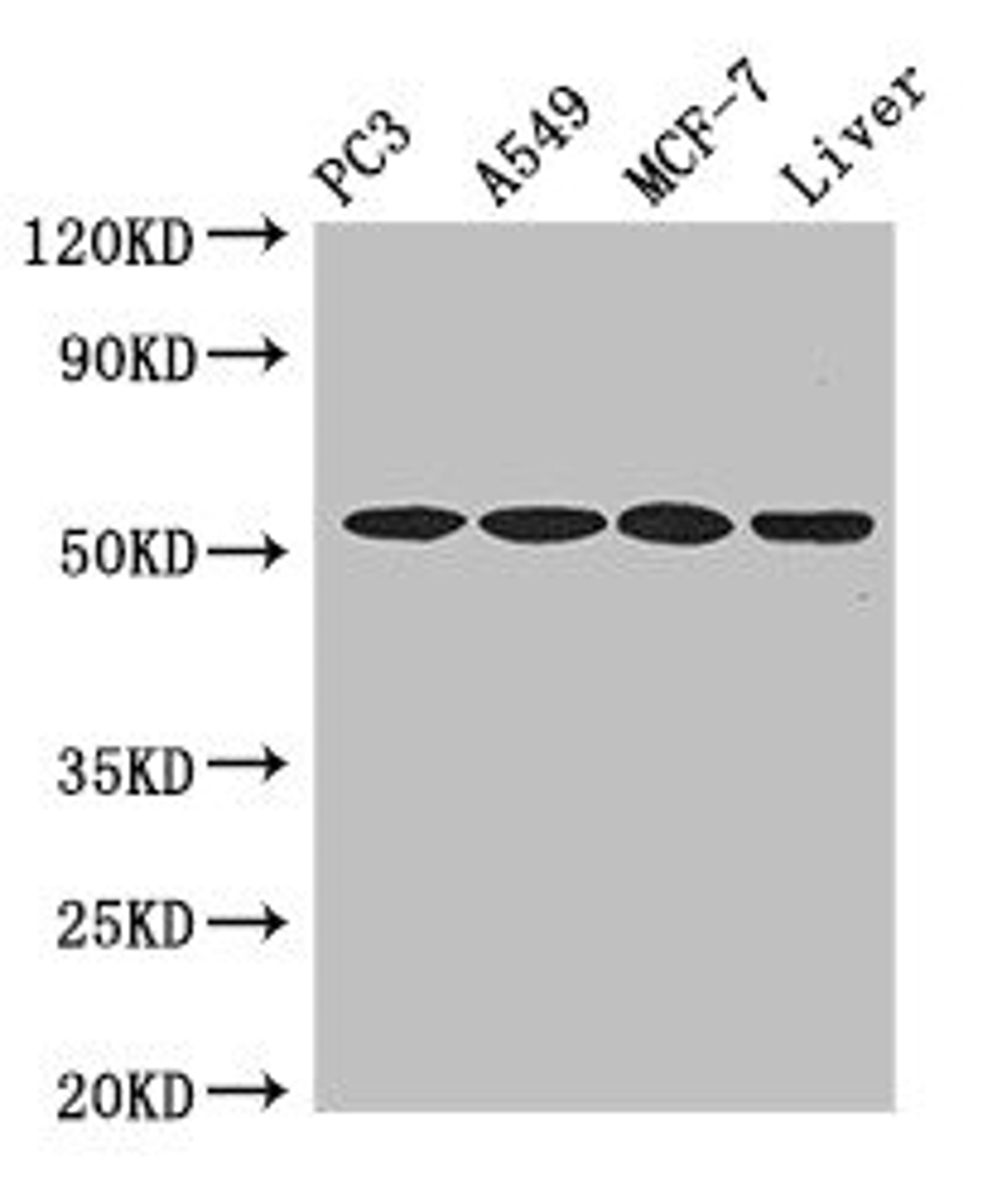 Western Blot. Positive WB detected in: PC-3 whole cell lysate, A549 whole cell lysate, MCF-7 whole cell lysate, , Mouse liver tissue. All lanes: IRF6 antibody at 4ug/ml. Secondary. Goat polyclonal to rabbit IgG at 1/50000 dilution. Predicted band size: 54, 42 kDa. Observed band size: 54 kDa. 