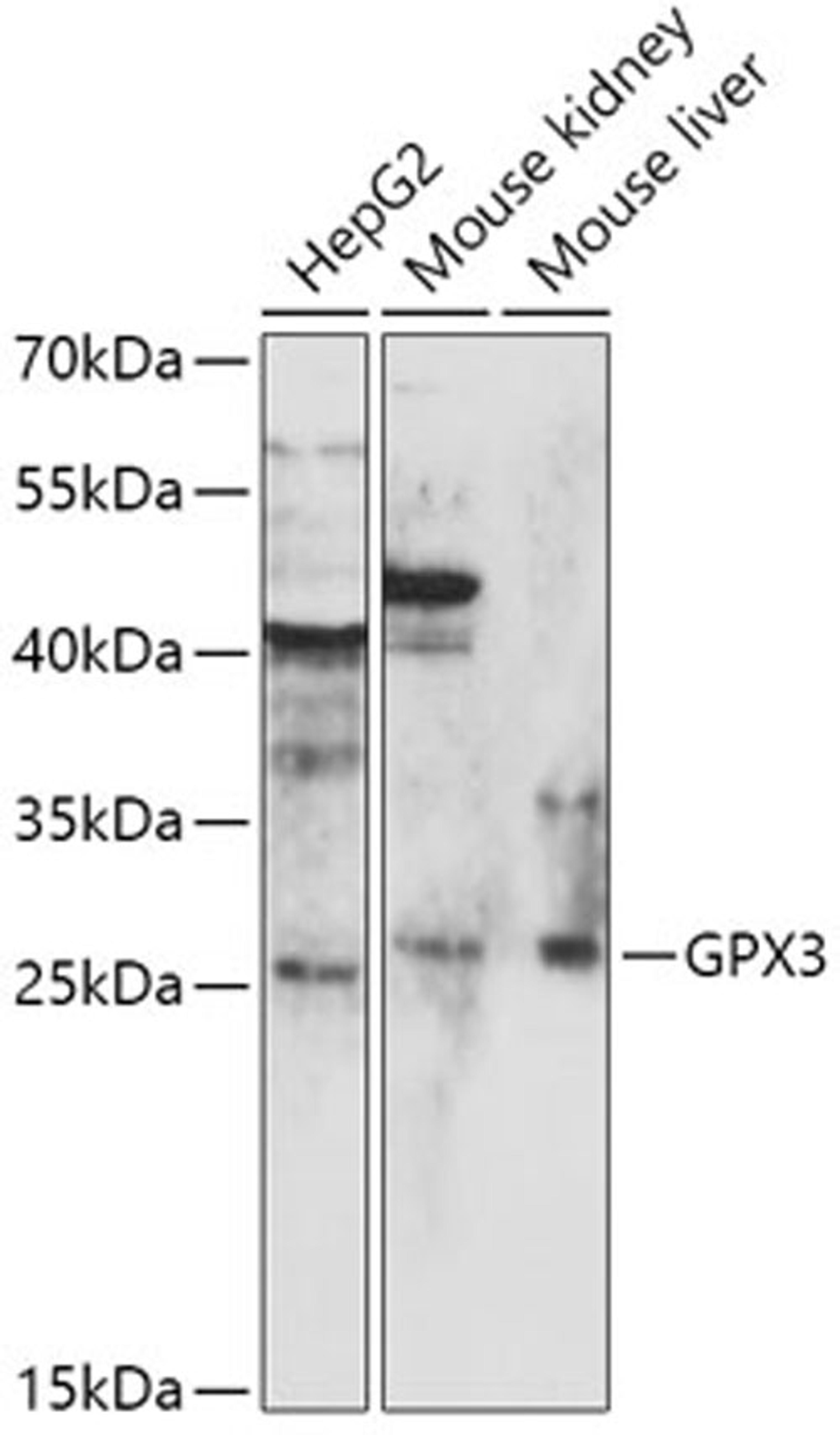 Western blot - GPX3 antibody (A12956)