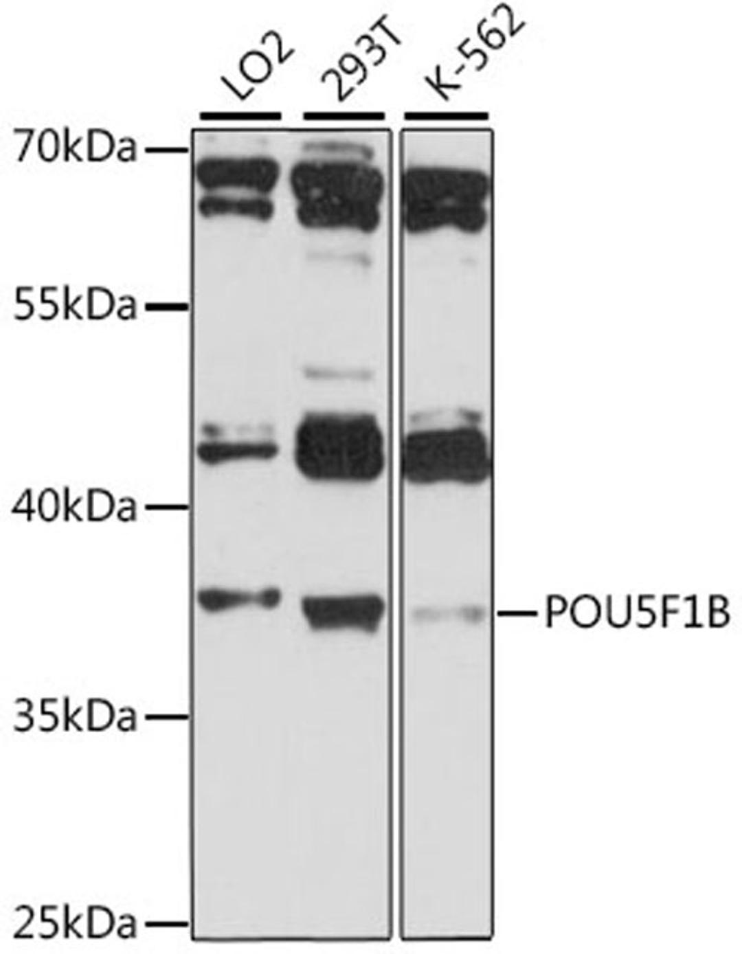 Western blot - POU5F1B antibody (A15705)