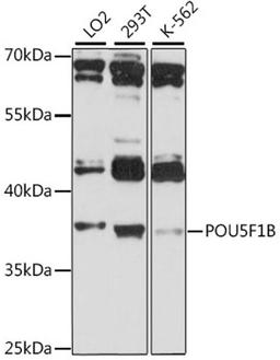 Western blot - POU5F1B antibody (A15705)