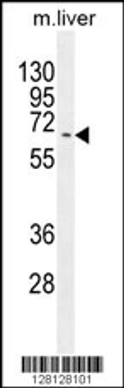 Western blot analysis in mouse liver tissue lysates (35ug/lane).