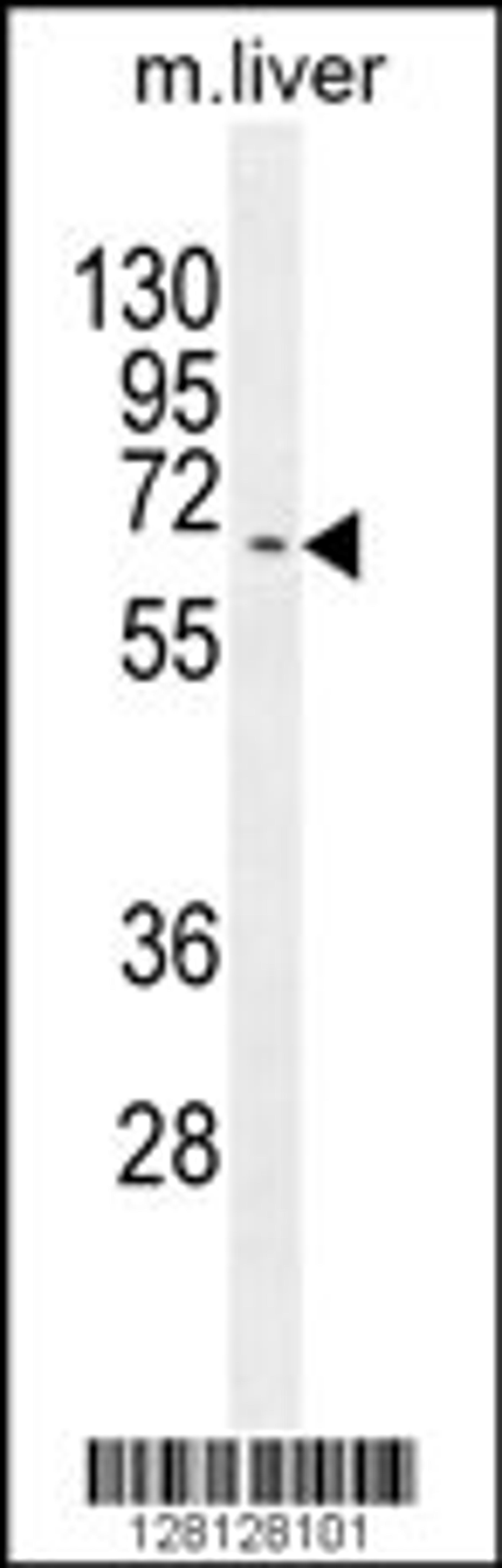 Western blot analysis in mouse liver tissue lysates (35ug/lane).