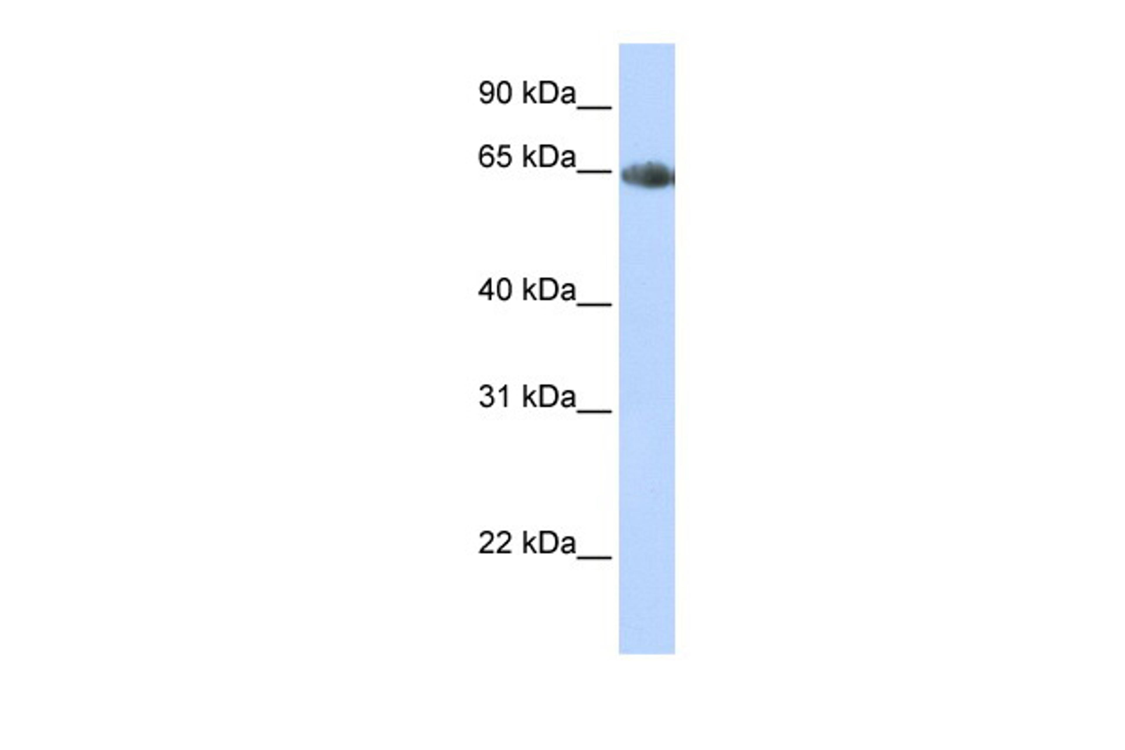 Antibody used in WB on Human Heart at 0.2-1 ug/ml.