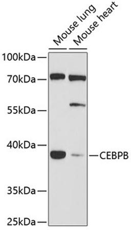 Western blot - CEBPB antibody (A0711)