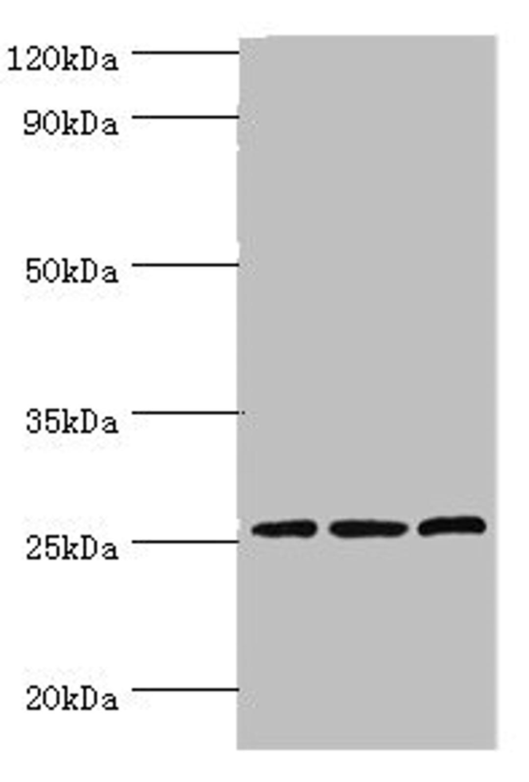 Western blot. All lanes: Claudin-14 antibody at 4ug/ml. Lane 1: Rat liver tissue. Lane 2: Mouse kidney tissue. Lane 3: Hela whole cell lysate. Secondary. Goat polyclonal to rabbit IgG at 1/10000 dilution. Predicted band size: 26 kDa. Observed band size: 26 kDa.