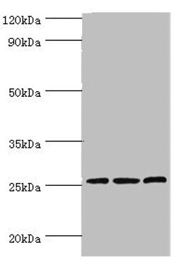 Western blot. All lanes: Claudin-14 antibody at 4ug/ml. Lane 1: Rat liver tissue. Lane 2: Mouse kidney tissue. Lane 3: Hela whole cell lysate. Secondary. Goat polyclonal to rabbit IgG at 1/10000 dilution. Predicted band size: 26 kDa. Observed band size: 26 kDa.