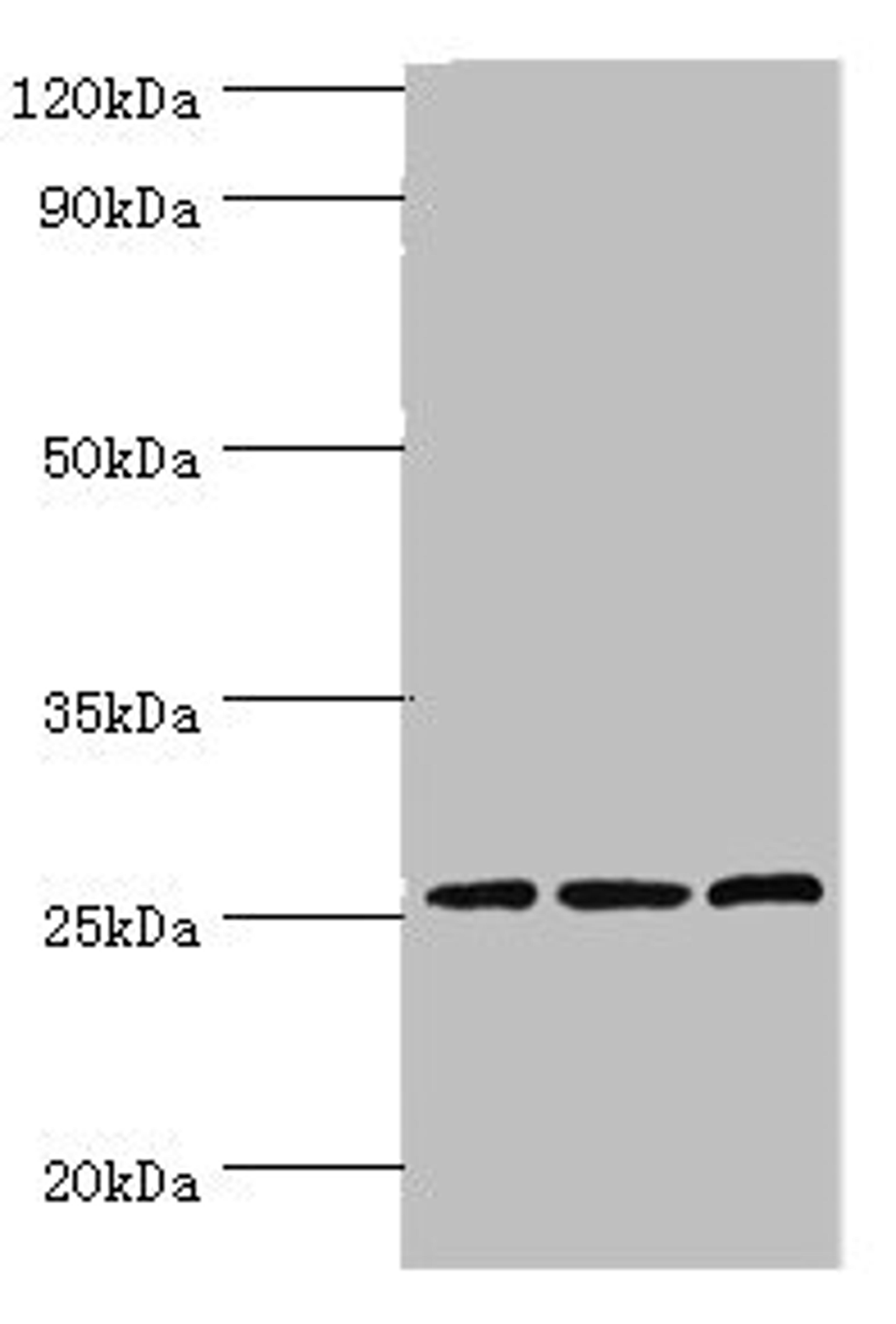 Western blot. All lanes: Claudin-14 antibody at 4ug/ml. Lane 1: Rat liver tissue. Lane 2: Mouse kidney tissue. Lane 3: Hela whole cell lysate. Secondary. Goat polyclonal to rabbit IgG at 1/10000 dilution. Predicted band size: 26 kDa. Observed band size: 26 kDa.