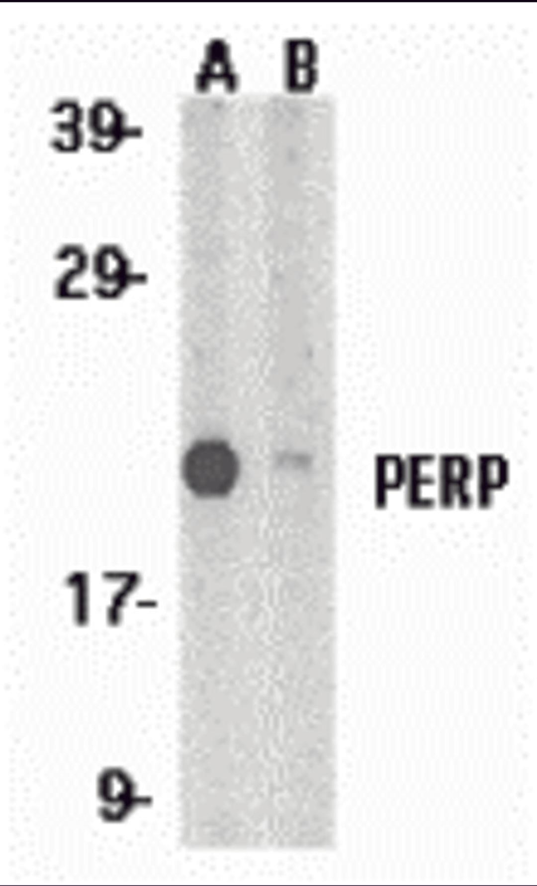Western blot analysis of PERP expression in A431 whole cell lysates in the absence (A) and presence (B) of blocking peptide with PERP antibody at 1 μg/mL.