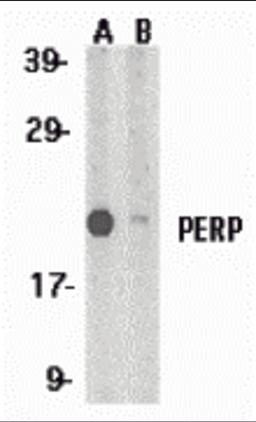 Western blot analysis of PERP expression in A431 whole cell lysates in the absence (A) and presence (B) of blocking peptide with PERP antibody at 1 μg/mL.