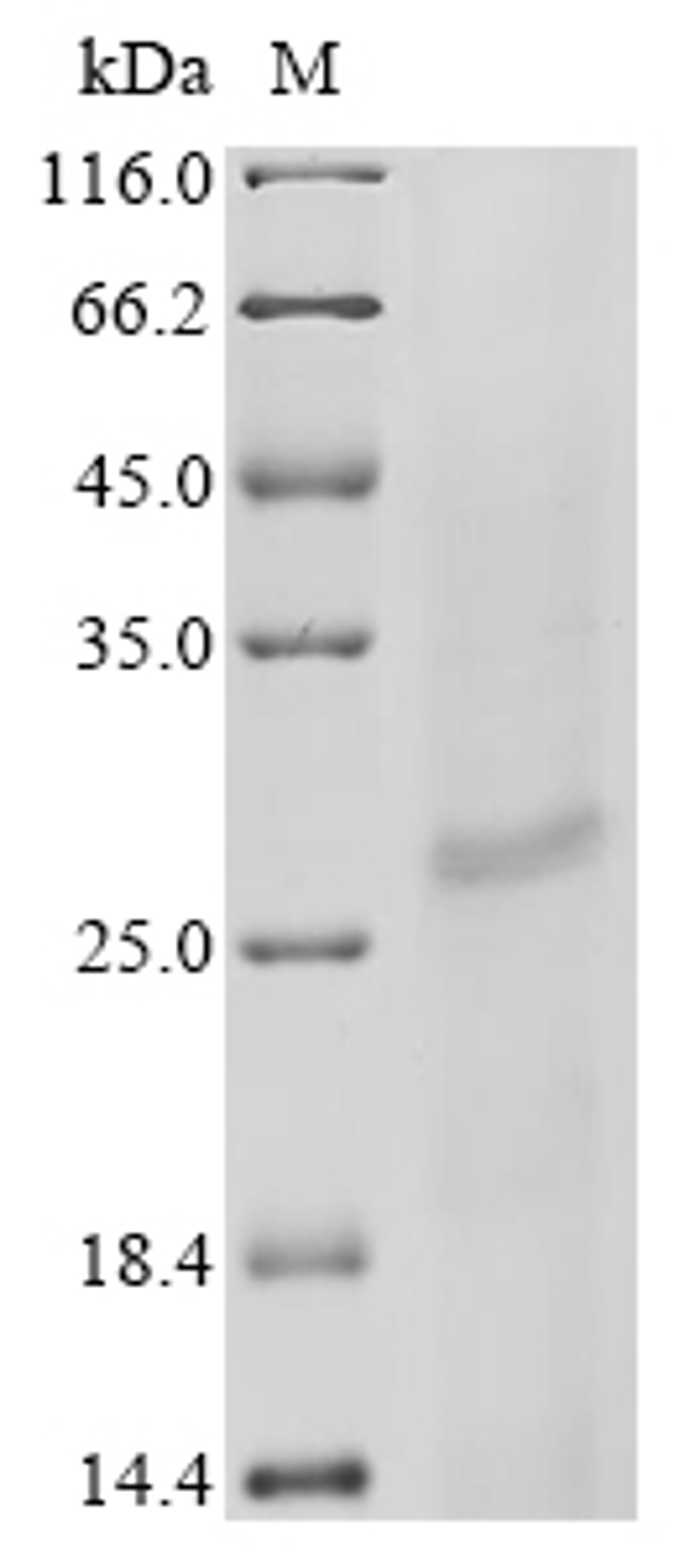 (Tris-Glycine gel) Discontinuous SDS-PAGE (reduced) with 5% enrichment gel and 15% separation gel.