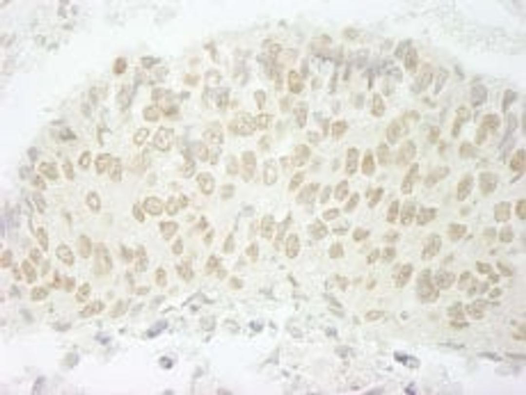 Detection of human SFRS8/SWAP by immunohistochemistry.