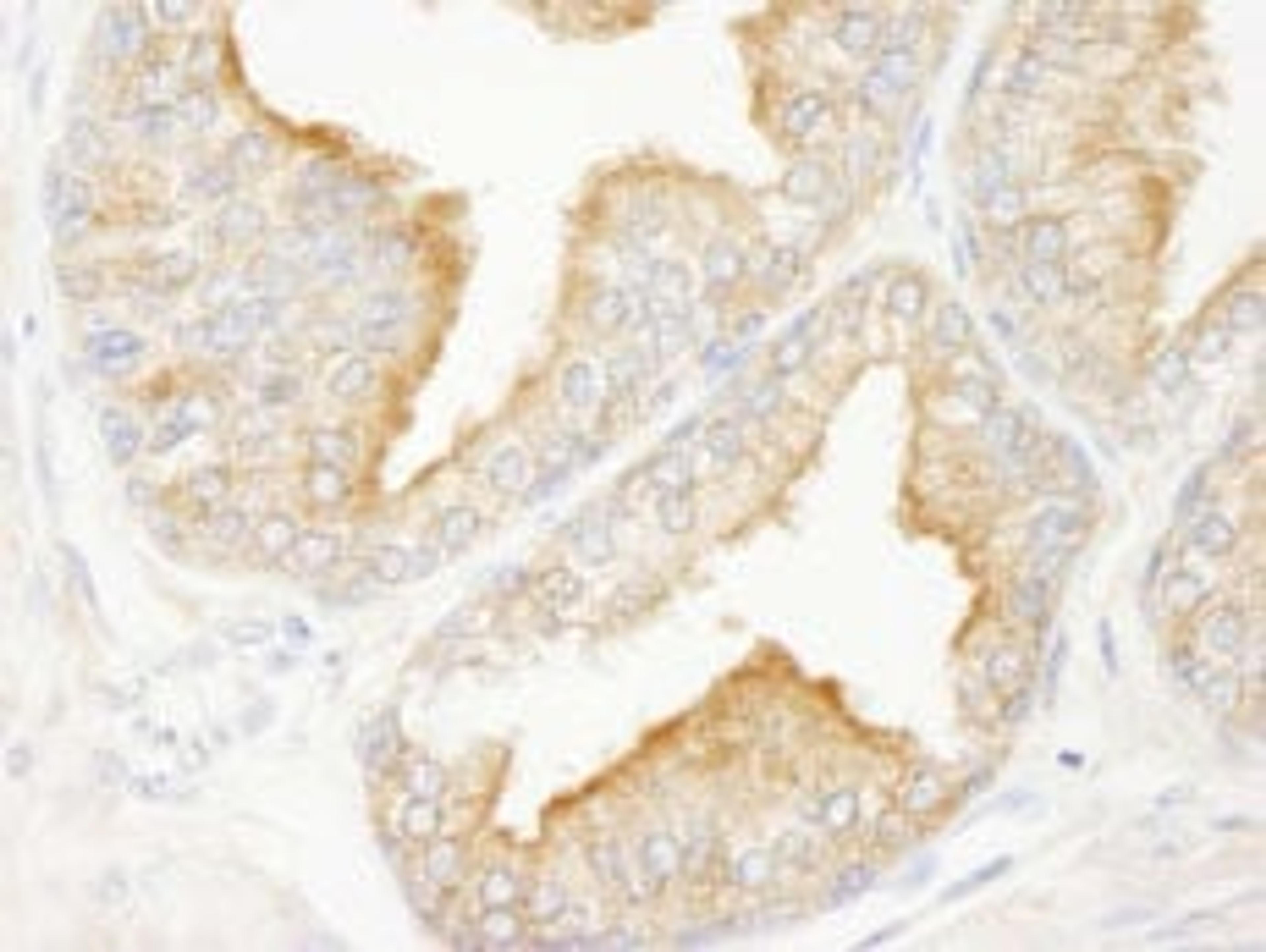 Detection of human KANK2/SIP by immunohistochemistry.