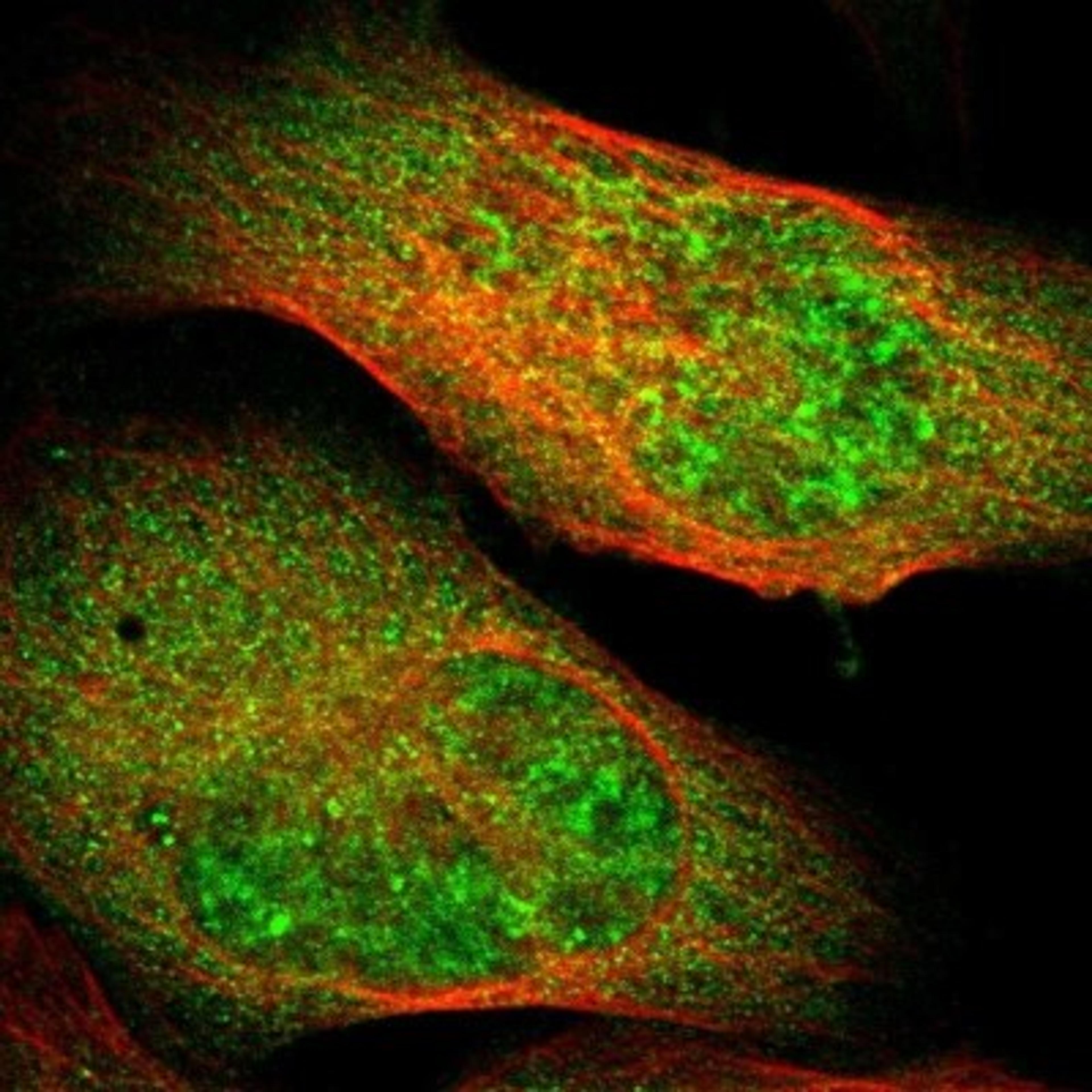 Immunocytochemistry/Immunofluorescence: PLAGL2 Antibody [NBP1-80584] - Staining of human cell line U-2 OS shows positivity in nucleus but not nucleoli & cytoplasm.