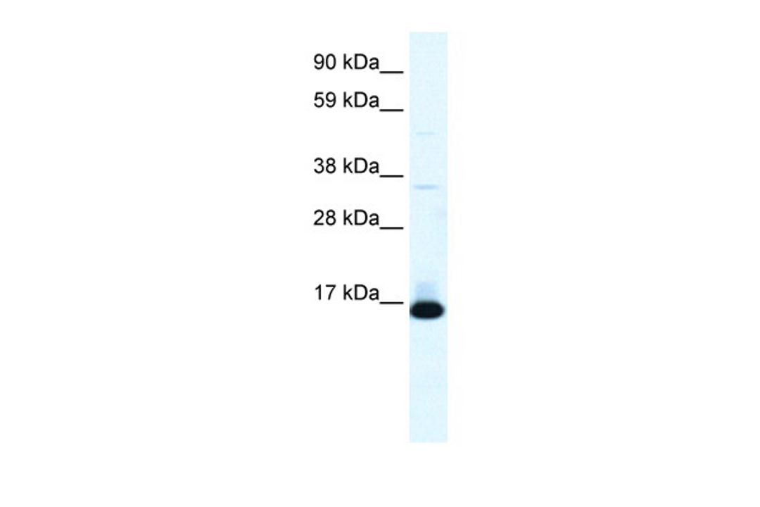 Antibody used in WB on Human Lung at 0.2-1 ug/ml.