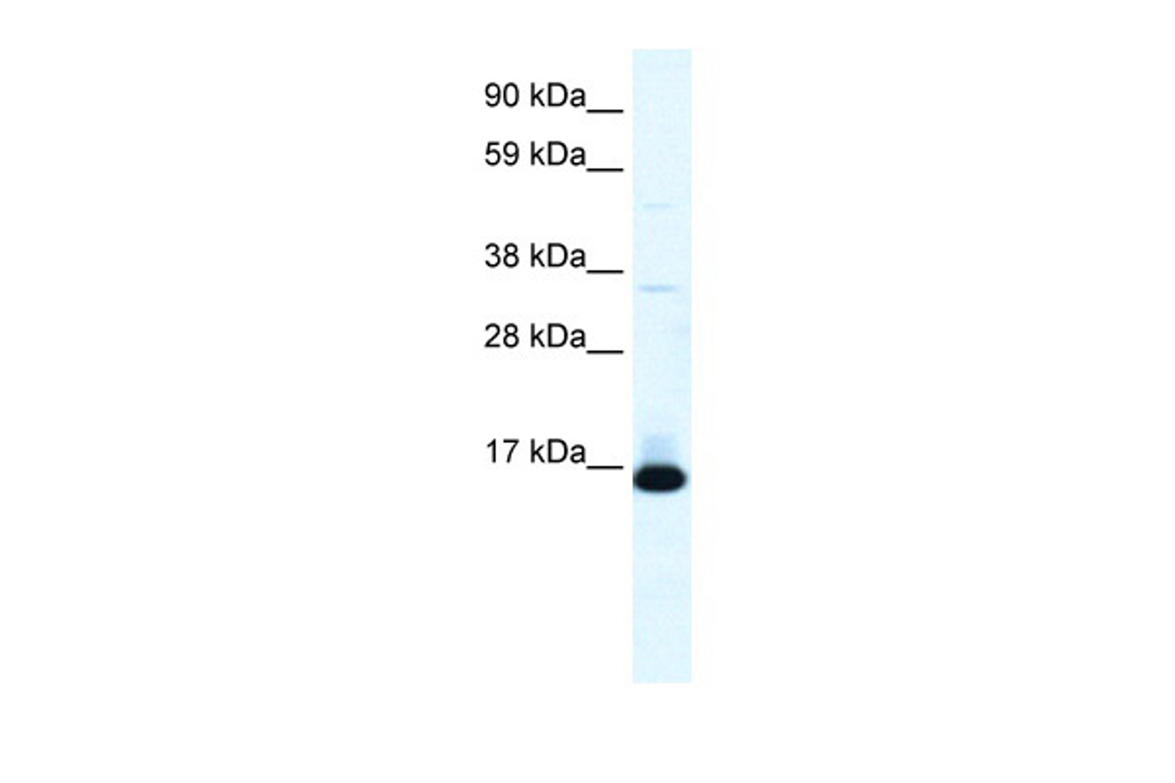 Antibody used in WB on Human Lung at 0.2-1 ug/ml.