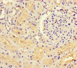 Immunohistochemistry of paraffin-embedded human kidney tissue using CSB-PA010050LA01HU at dilution of 1:100