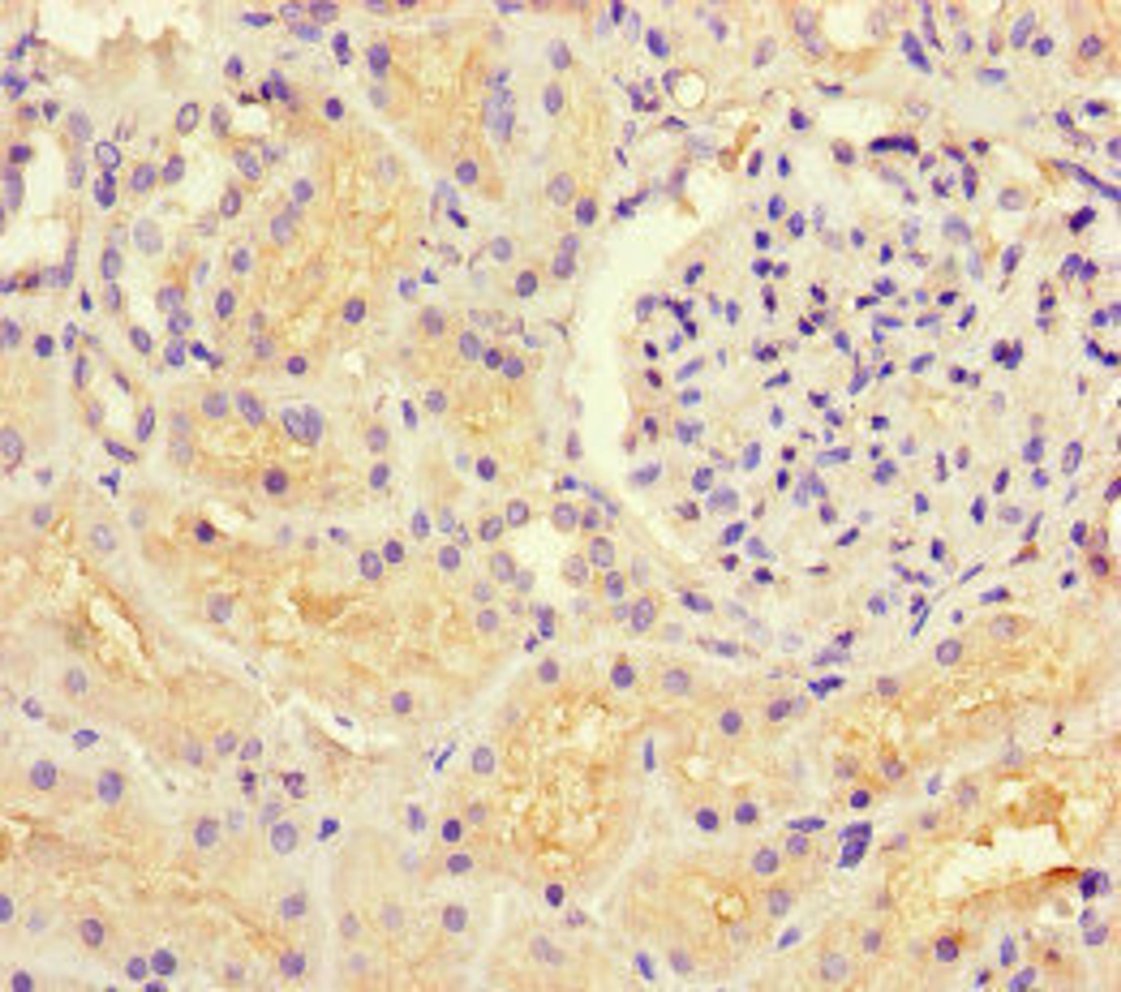 Immunohistochemistry of paraffin-embedded human kidney tissue using CSB-PA010050LA01HU at dilution of 1:100