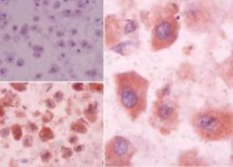 Immunohistochemistry-Paraffin: S1P3/EDG-3 Antibody [NBP2-24762] - EDG3 in formalin-fixed, paraffin-embedded human liver tissue using an isotype control (top left) and NBP2-24762 (bottom left, right) at 5 ug/ml.