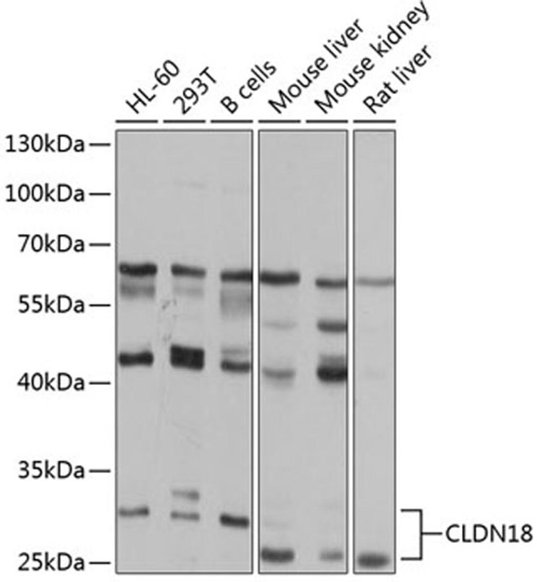 Western blot - CLDN18 antibody (A8392)