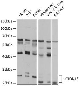 Western blot - CLDN18 antibody (A8392)