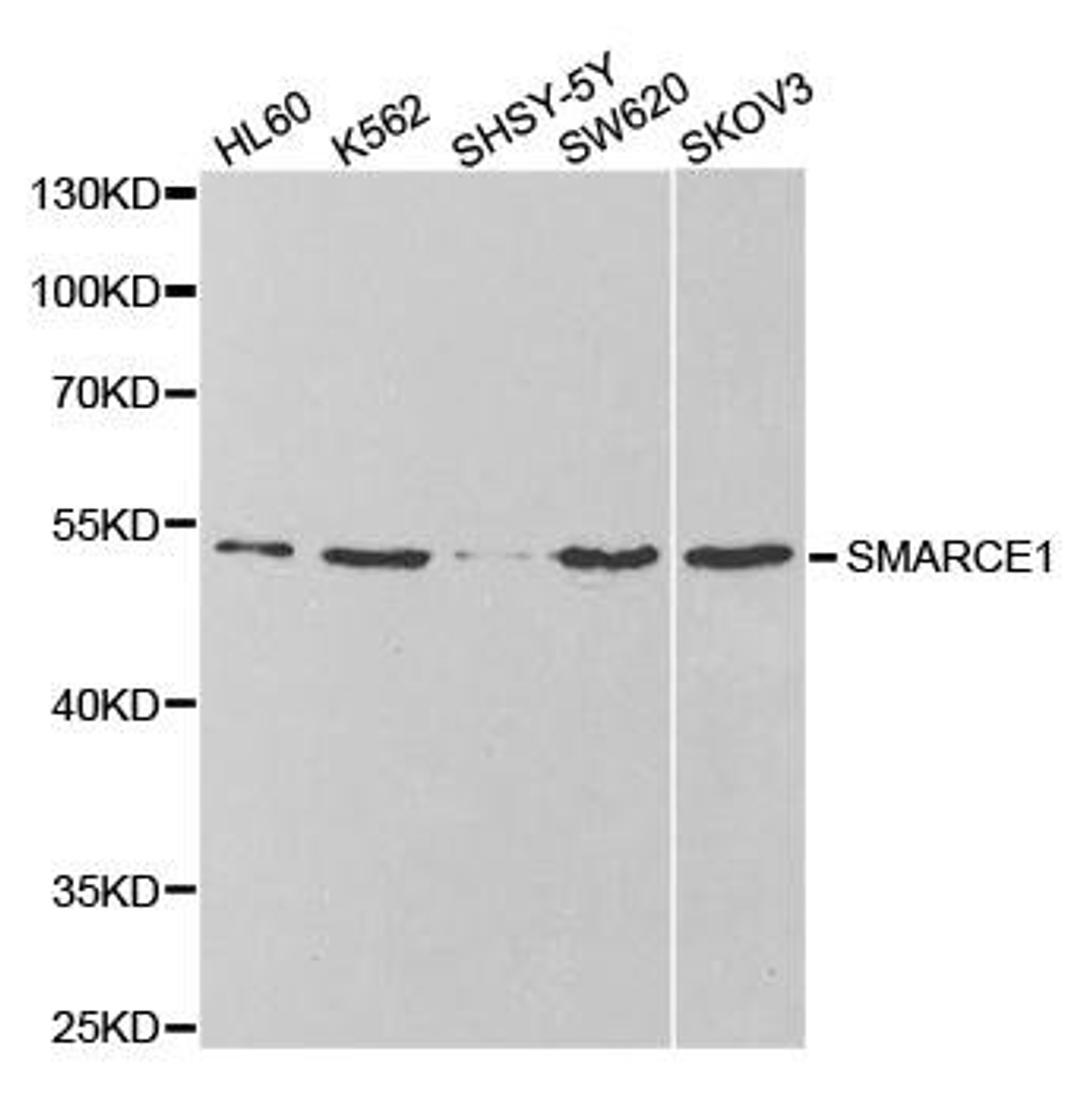 Western blot analysis of extracts of various cell lines using SMARCE1 antibody