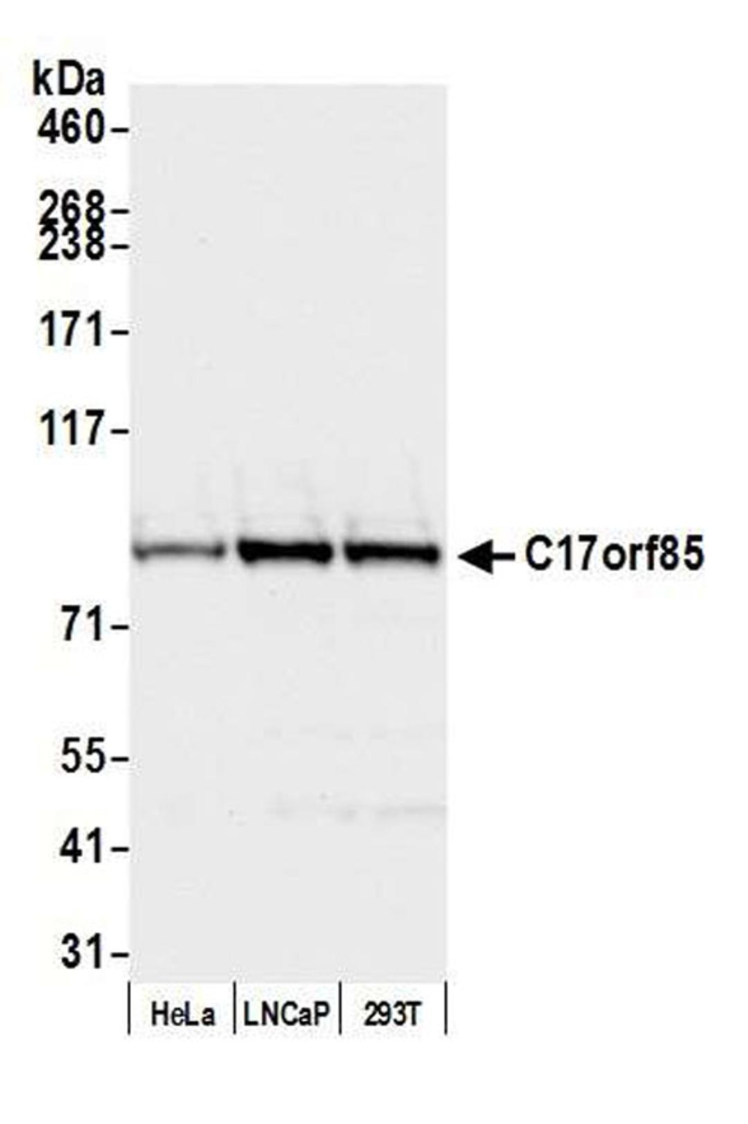 Detection of human C17orf85 by WB.