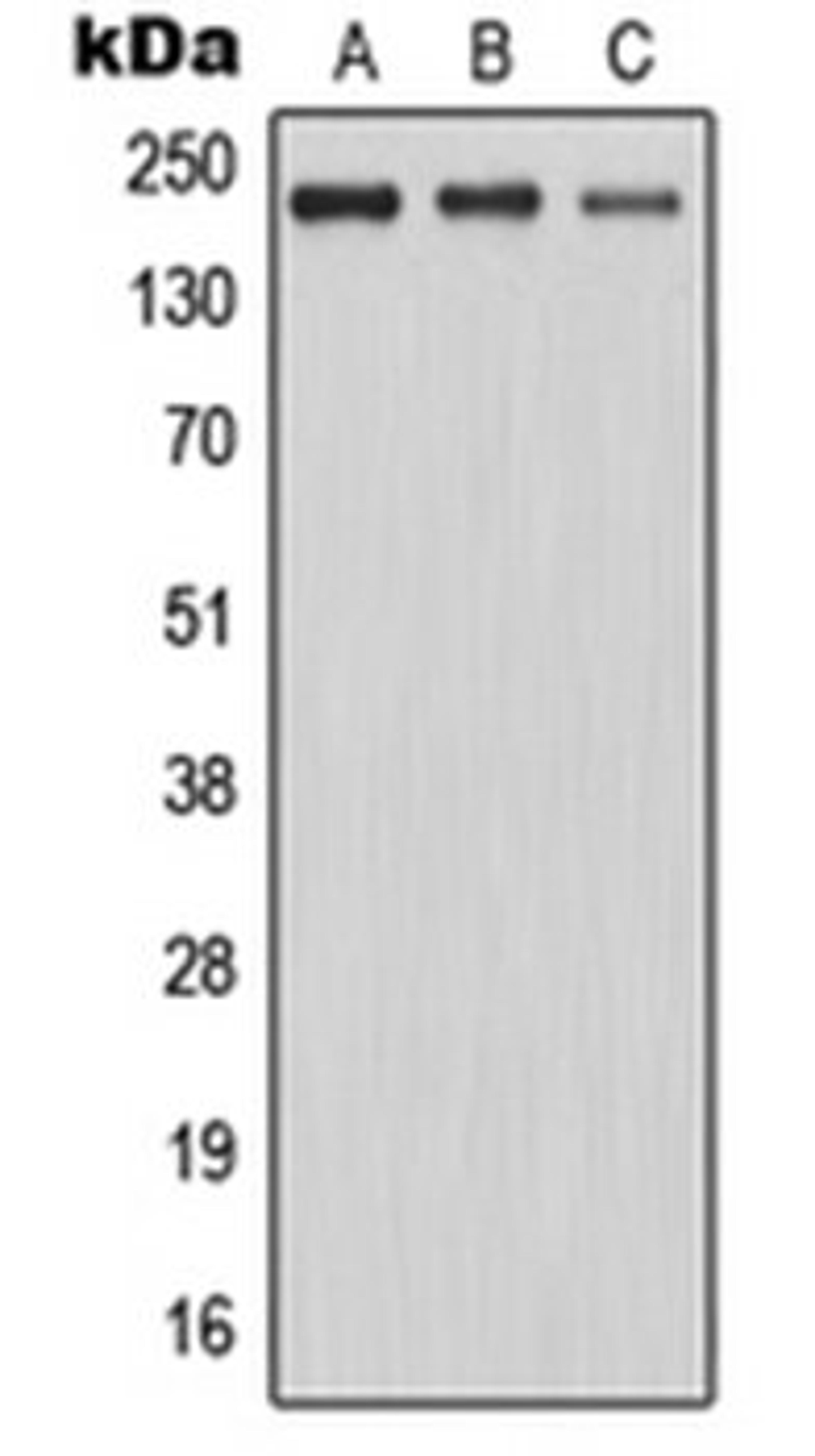 Western blot analysis of K562 (Lane 1), HeLa (Lane 2), Jurkat (Lane 3) whole cell lysates using MAST2 antibody