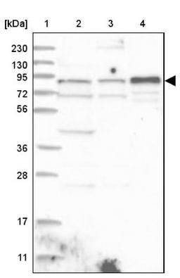 Western Blot: ZNF263 Antibody [NBP1-81868] - Lane 1: Marker [kDa] 230, 130, 95, 72, 56, 36, 28, 17, 11<br/>Lane 2: Human cell line RT-4<br/>Lane 3: Human cell line U-251MG sp<br/>Lane 4: Human plasma (IgG/HSA depleted)