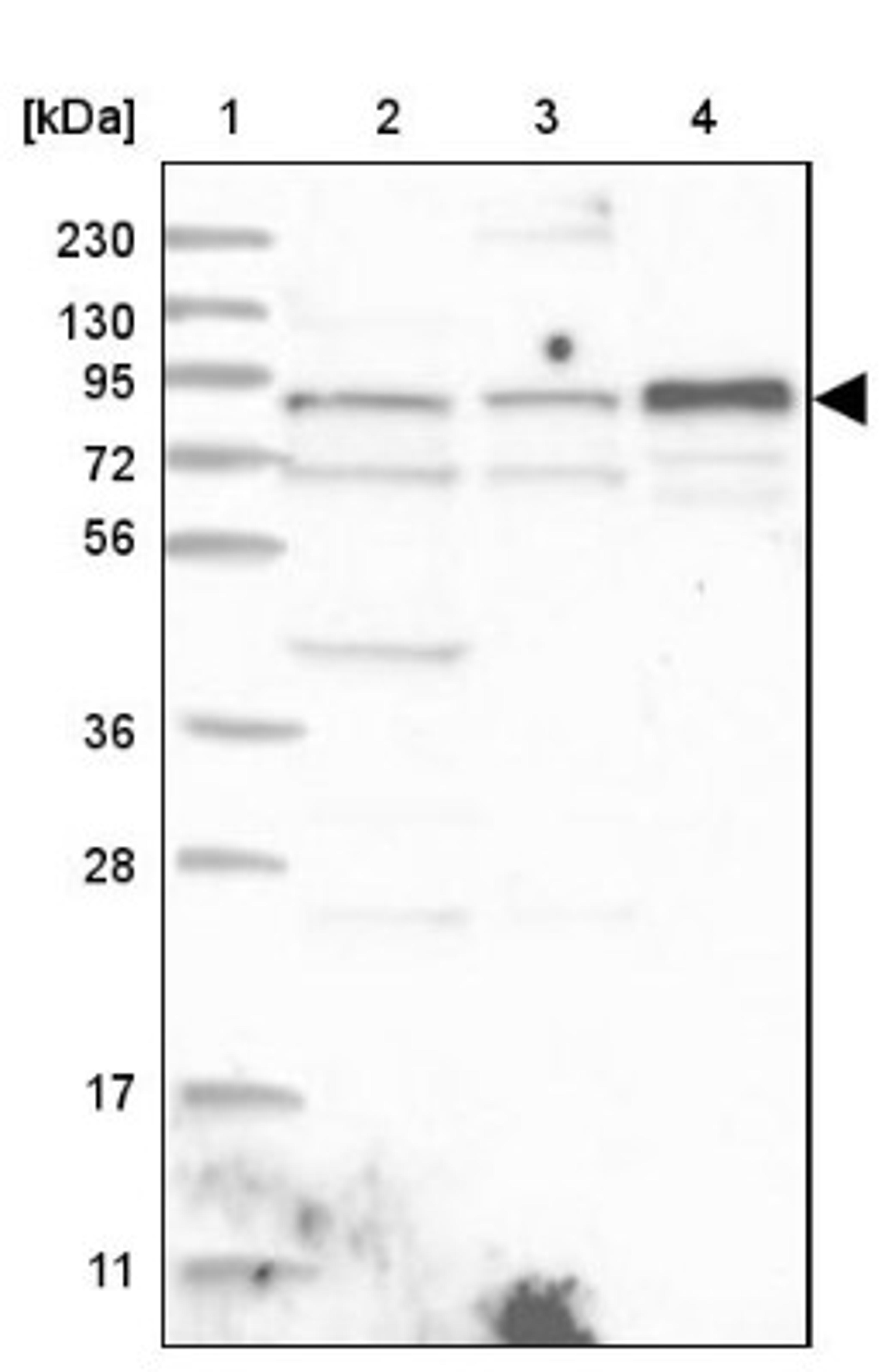 Western Blot: ZNF263 Antibody [NBP1-81868] - Lane 1: Marker [kDa] 230, 130, 95, 72, 56, 36, 28, 17, 11<br/>Lane 2: Human cell line RT-4<br/>Lane 3: Human cell line U-251MG sp<br/>Lane 4: Human plasma (IgG/HSA depleted)