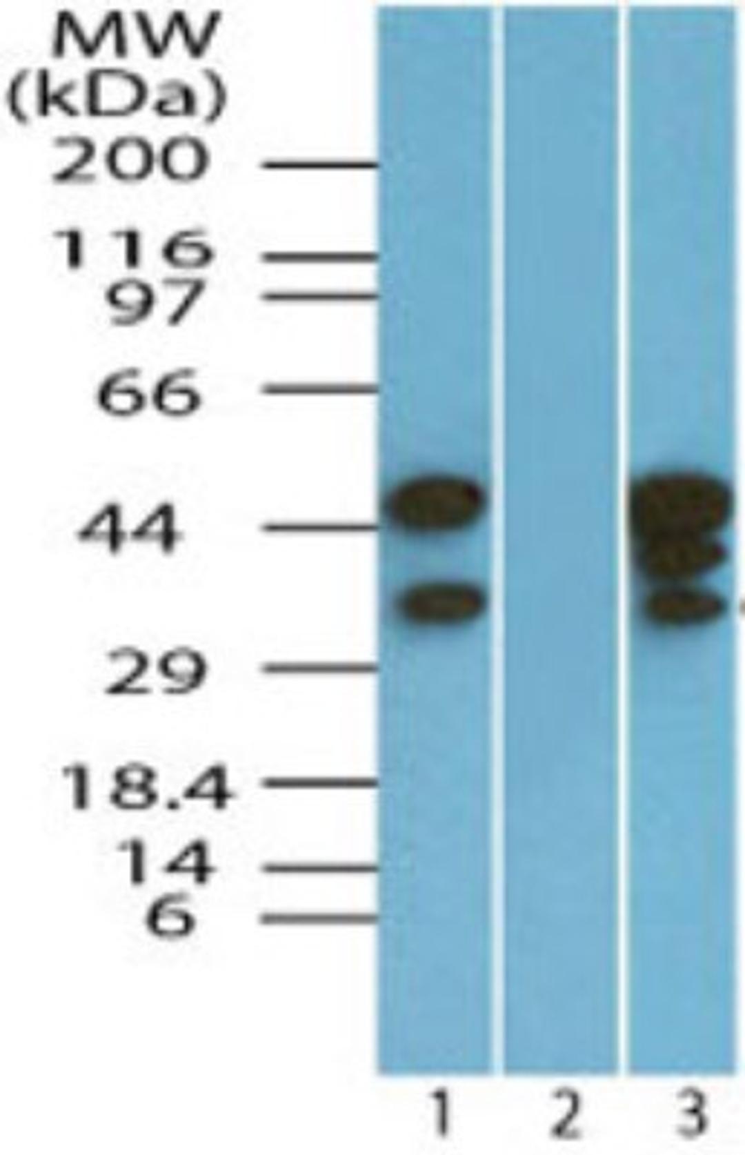 Western Blot: EIF3G Antibody [NBP2-24524] - analysis of eIF3G in Ramos cell lysate in the 1) absence and 2) presence of immunizing peptide and 3) RAW cell lysate using this antibody. 025 ug/ml. I goat anti-rabbit Ig HRP secondary antibody and PicoTect ECL substrate solution were used for this test.