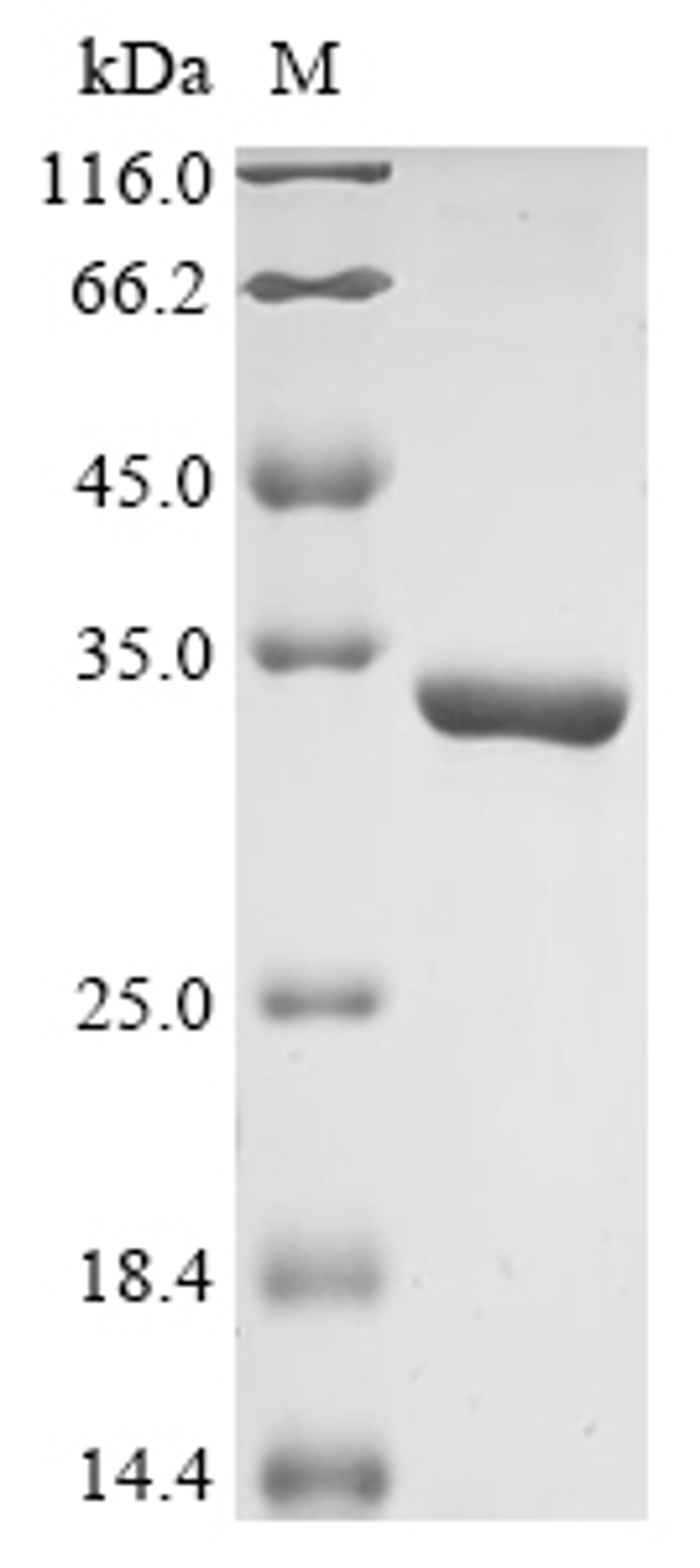 (Tris-Glycine gel) Discontinuous SDS-PAGE (reduced) with 5% enrichment gel and 15% separation gel.