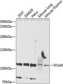 Western blot - ITGAE antibody (A9934)