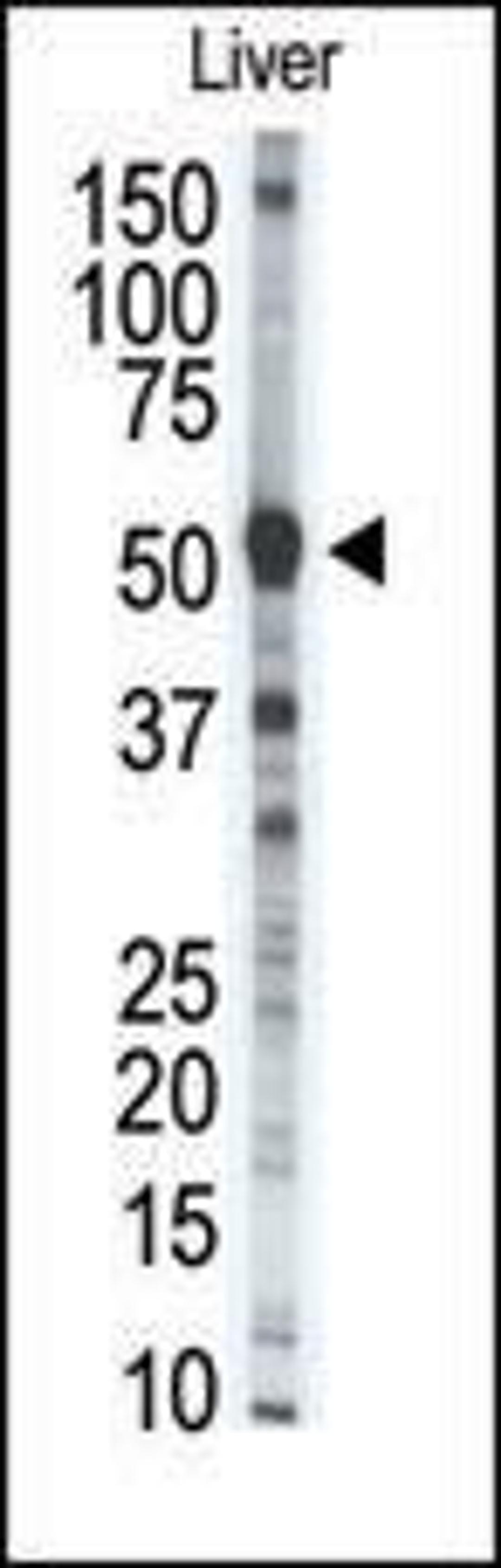 Western blot analysis of anti-MMP8 Pab in mouse liver tissue lysate (35ug/lane).