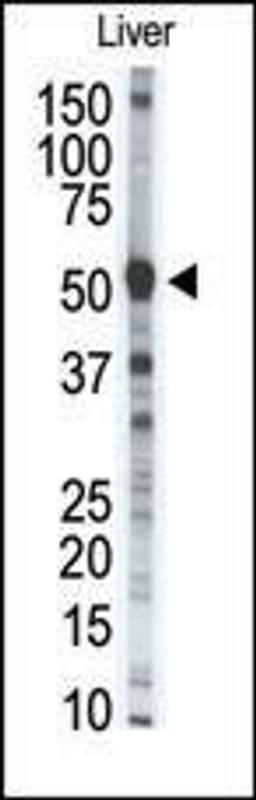 Western blot analysis of anti-MMP8 Pab in mouse liver tissue lysate (35ug/lane).