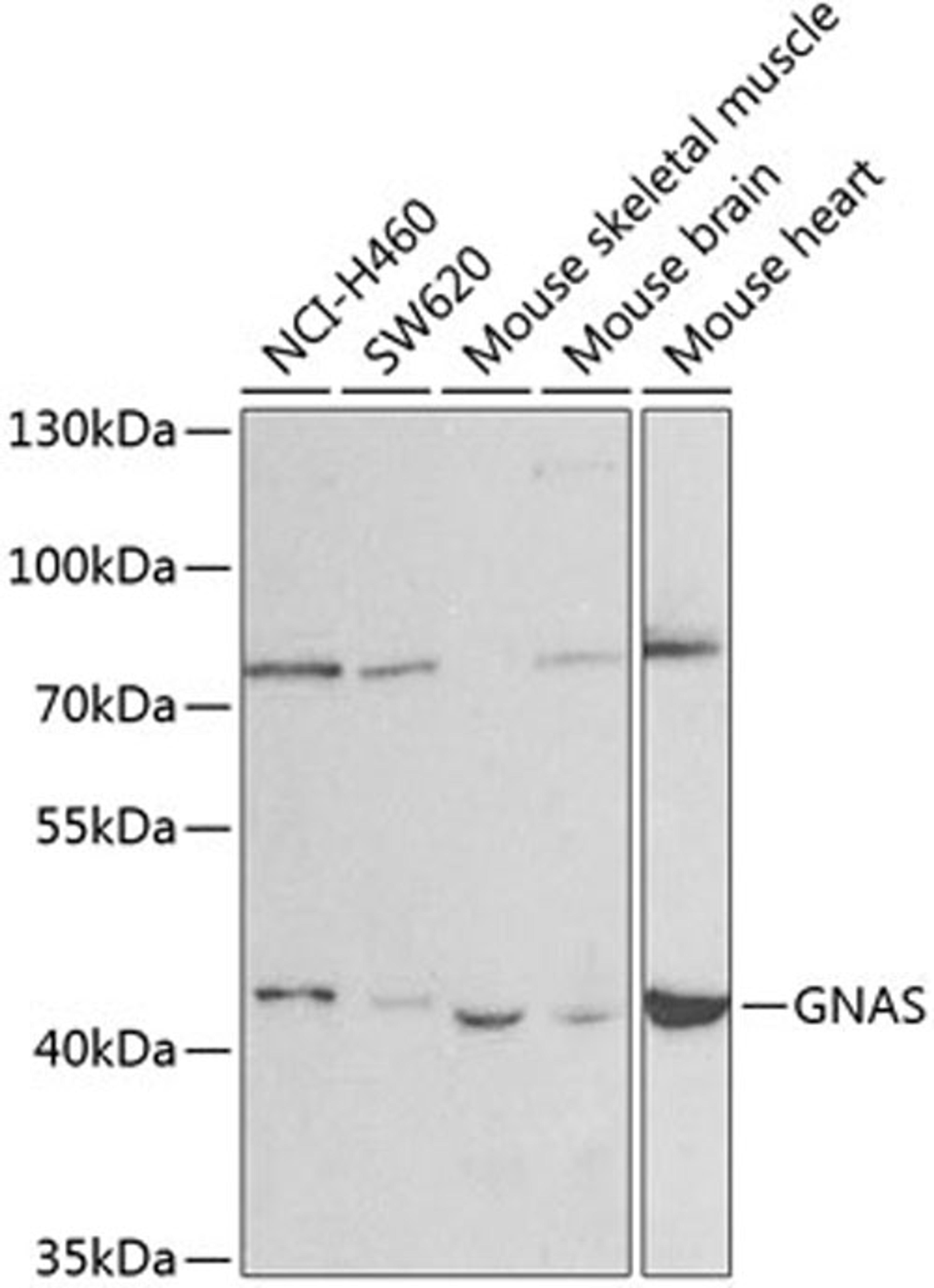 Western blot - GNAS antibody (A2732)