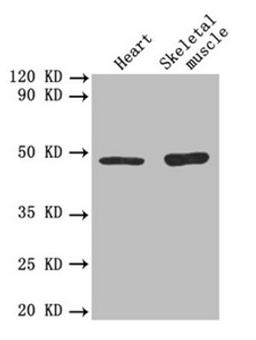 Western blot. All lanes: TGFB2 antibody at 3µg/ml. Lane 1: Mouse heart tissue. Lane 2: Mouse skeletal muscle tissue. Secondary. Goat polyclonal to rabbit IgG at 1/10000 dilution. Predicted band size: 48, 51 kDa. Observed band size: 48 kDa