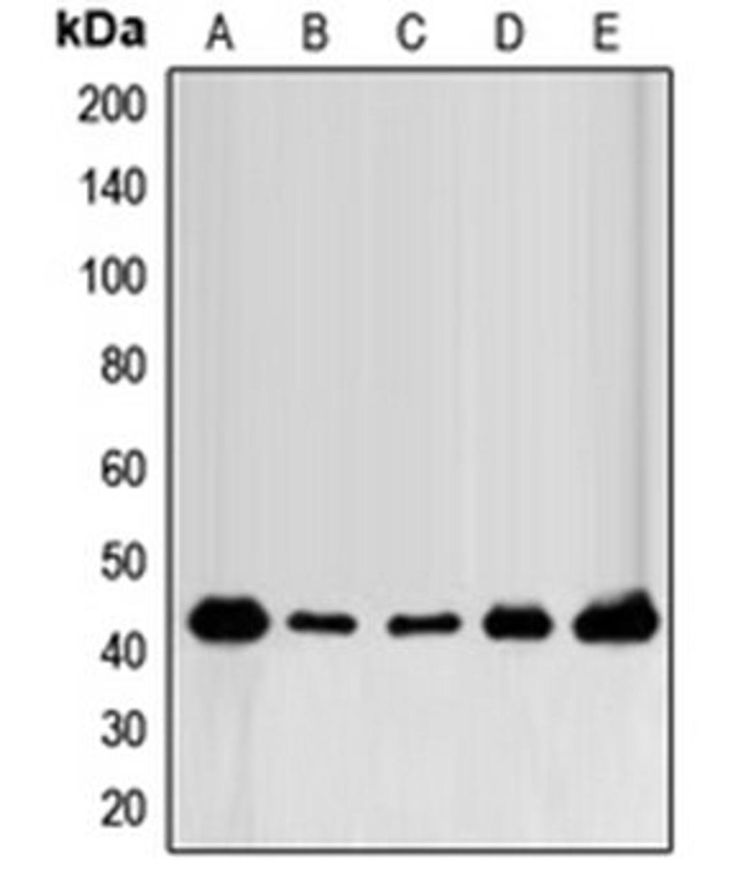 Western blot analysis of MCF7 (Lane 1), MDAMB231 (Lane 2), MDAMB435 (Lane 3), mouse brain (Lane 4), rat brain (Lane 5) whole cell lysates using FGFR1OP antibody