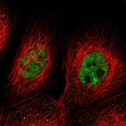 Immunocytochemistry/Immunofluorescence: C4orf52 Antibody [NBP1-90943] - Staining of human cell line A-431 shows positivity in nuclei but not nucleoli.