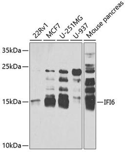 Western blot - IFI6 antibody (A6157)